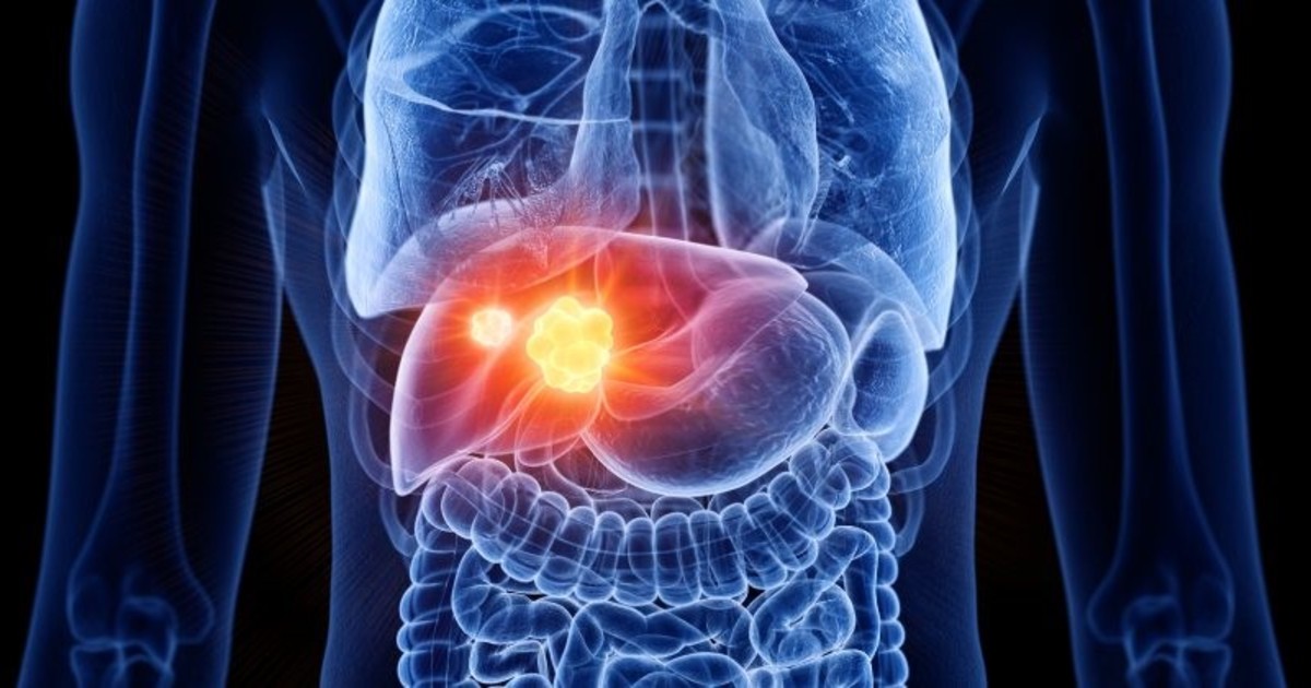 Investigadores de la Universidad Austral bloquean proteína y potencian inmunoterapia contr